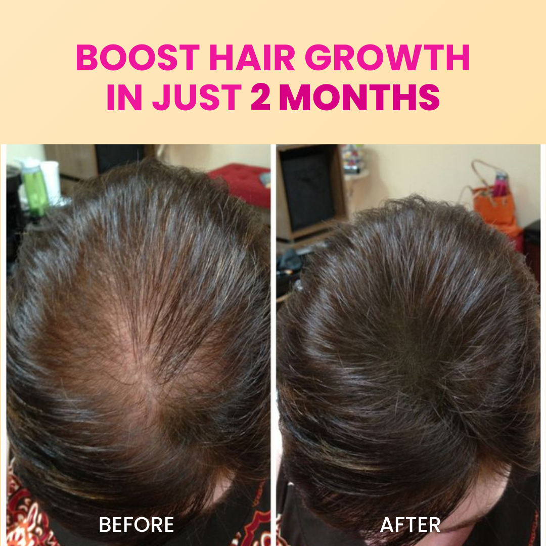 Advanced Hair Growth Oil & Shampoo Combo