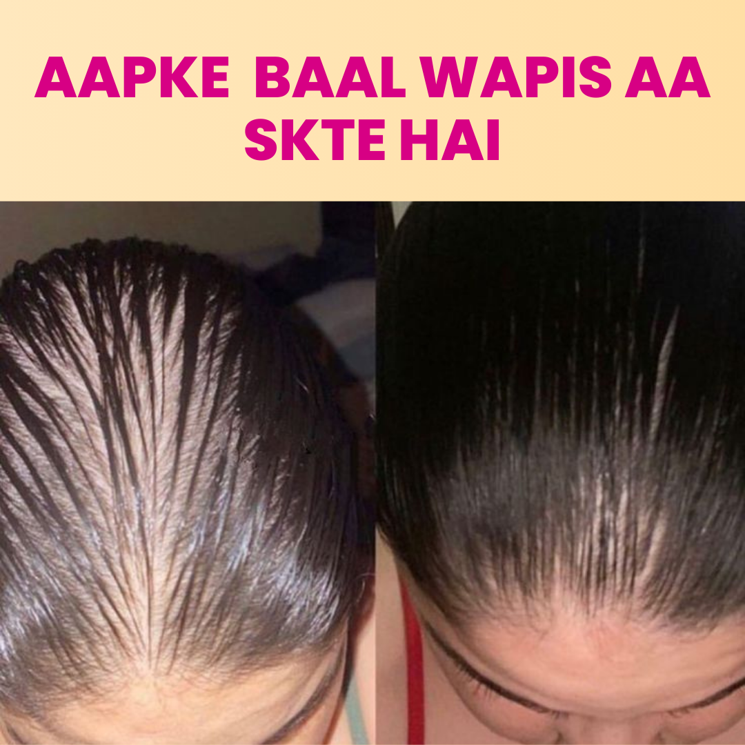 Advanced Hair Growth Oil | Onion & Black Seed Hair Oil | 200 ml