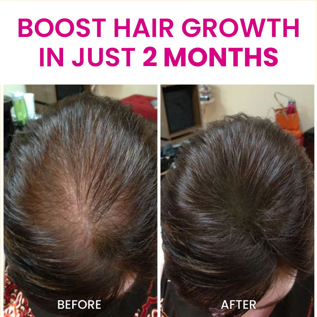 Advanced Hair Growth Oil & Shampoo Combo